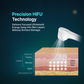 Ultralift – High Intensity Focused Ultrasound (HIFU)